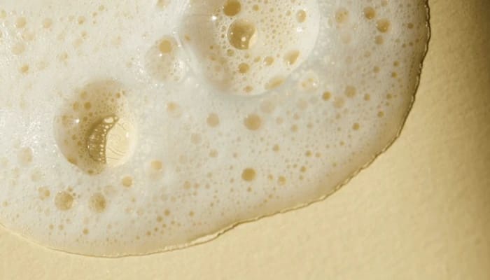 genişlemiş gözenekler mi dediniz?